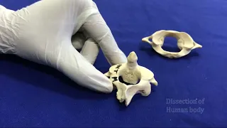 Atypical cervical vertebrae: Atlas(C1), Axis(C2) and Vertebra prominens(C7).