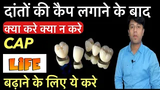 दांतों पर कैप लगाने के बाद ध्यान रखने योग्य जानकारी || Tooth cap caring tips