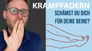 Das EINZIGE was WIRKLICH gegen Krampfadern hilft!