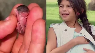 12 Years Old Girl Gives Birth When Doctor Put The Baby In His Fingers He Was Shocked!