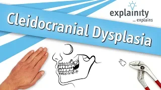 Cleidocranial Dysplasia explained (explainity® explainer video)