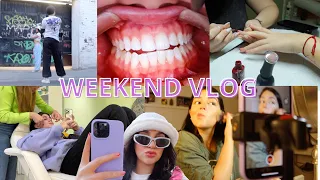 WEEKEND VLOG (Sonrisa nueva, new nails y fotitos para insta) || Marbloggss