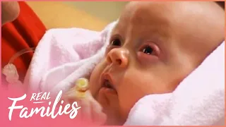 My Baby Desperately Needs Eye Surgery | Little Miracles | Real Families