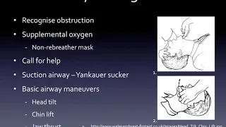 Airway management