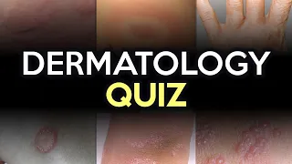 Dermatology Quiz