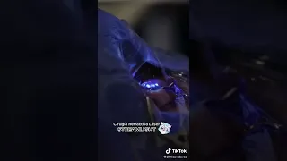 Así se ve el láser moldeando la cornea en una Cirugía Refractiva