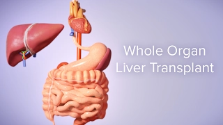 Liver Transplant | Cincinnati Children's