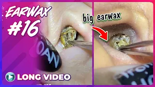 EP 16 Earwax ASMR. What's in ears that haven't been cleaned for a long time?