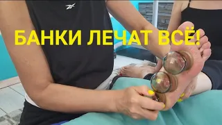 Банки лечат всё! Огненный массаж стопы. 😳😲 #DIY #massage #health