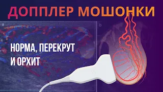 УЗИ мошонки. Часть2. Допплер яичек в норме: кровоснабжение, цдк, спектральный и энергетичекий доплер