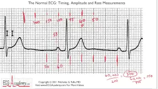 Determining Rate 6-3 - ECG / EKG Interpretation -- BASIC