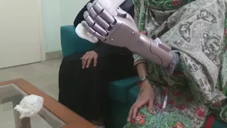 Smart Prosthetics Arms - Brain-controlled and AI embedded!