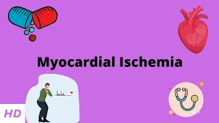 Myocardial Ischemia, Causes, Signs and Symptoms, Diagnosis and Treatment.