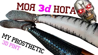 Мой протез, нога напечатана на 3д. My leg is printed on a 3D printer.  amputee leg prosthetic