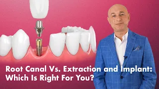 Root Canal Vs. Extraction and Implant: Which Is Right For You?