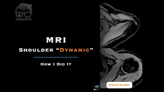 MRI SHOULDER “DYNAMIC” – HOW I DID IT