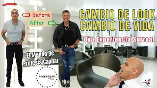 Ahora Sí Hay Pelo! Prótesis Capilar - Un Cambio Increíble!