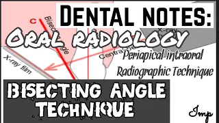 BISECTING LINE ANGLE RADIOGRAPHIC TECHNIQUE II LE MASTER TECHNIQUE?? II INTRAORAL RAGIOGRAPHY