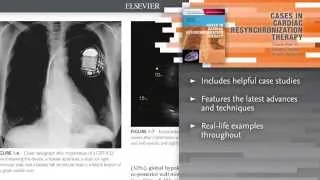 Cases in Cardiac Resynchronization Therapy