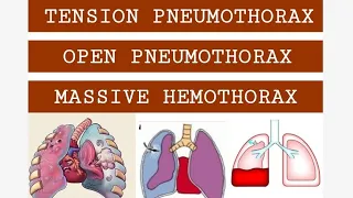 TENSION PNEUMOTHORAX, OPEN PNEUMOTHORAX & MASSIVE HEMOTHORAX