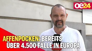 Affenpocken: Bereits über 4.500 fälle in Europa