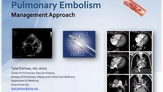 Pulmonary Embolism, An approach to Management -- BAVLS