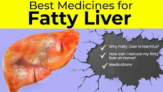 Best Medicines for Fatty Liver Diseases | Fatty Liver Treatment | Fatty Liver