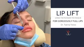 Lip Filler Lip Lift with the Russian Technique