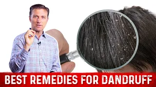 Best Natural & Home Remedies To Get Rid Of Dandruff – Dr. Berg