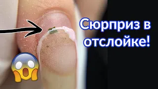 Снятие Гель-лака с Отслойками, Как сделать форму миндаль?