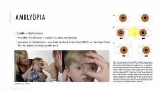 Amblyopia Diagnosis