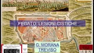 Giovanni Morana - Fegato: Lesioni Cistiche