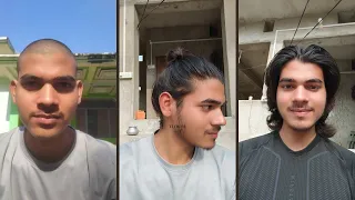 One Year Hair Growth Transformation l 365 days l Time lapse