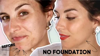 Cover Acne Scars WITHOUT Foundation? | Bailey B.