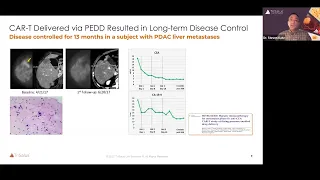 Webinar: “The PERIO-02 Trial – Enabling Immunotherapy for Intrahepatic Cholangiocarcinoma”