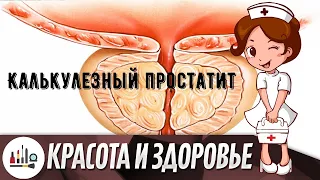 Калькулезный простатит