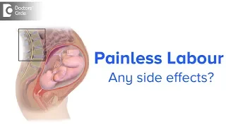 What is Painless Labour & is there any side effect?-Dr.Bhupinder Singh Duggal of Cloudnine Hospitals