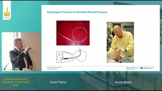 Transpulmonary pressure to optimize PEEP  [Pro-con]   ISICEM 2023