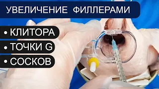 Увеличение клитора, точки G, сосков филлерами / контурная пластика/ гиалуроновая кислота