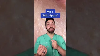 MILIA TREATMENT | DERMDOCTOR #shorts