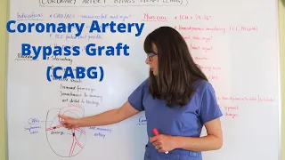 Coronary Artery Bypass Graft (CABG)