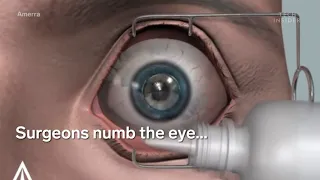 Eye Laser Treatment | 8 Medical Procedures That Are Improving Lives | Health Tech