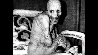 The Russian sleep experiment (CREEPY PASTA)