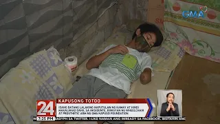 24 Oras: Batang naputulan ng kamay at hindi makalakad, binigyan ng wheelchair at prosthetic arm