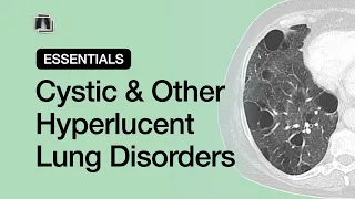 Cystic & Other Hyperlucent Lung Disorders | Chest Radiology Essentials