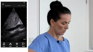 How to Perform Ultrasound of the Abdominal Aorta in a Lateral Position