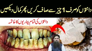 Teeth Cleaning at Home | Dant Saaf Karne Ka Tarika | Teeth White Karne Ka Tarika Dr Sharafat Ali New