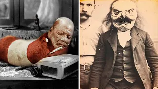 📷▶ 16 Circus Freaks That Actually Existed | RARE and BIZARRE Old Photos from History