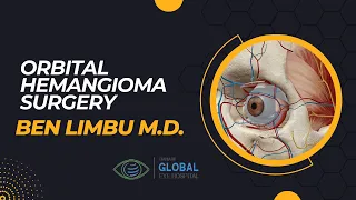 Orbital Hemangioma