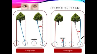 Бинокулярное зрение человека. Основы, подготовка к исследованию бинокулярной системы.